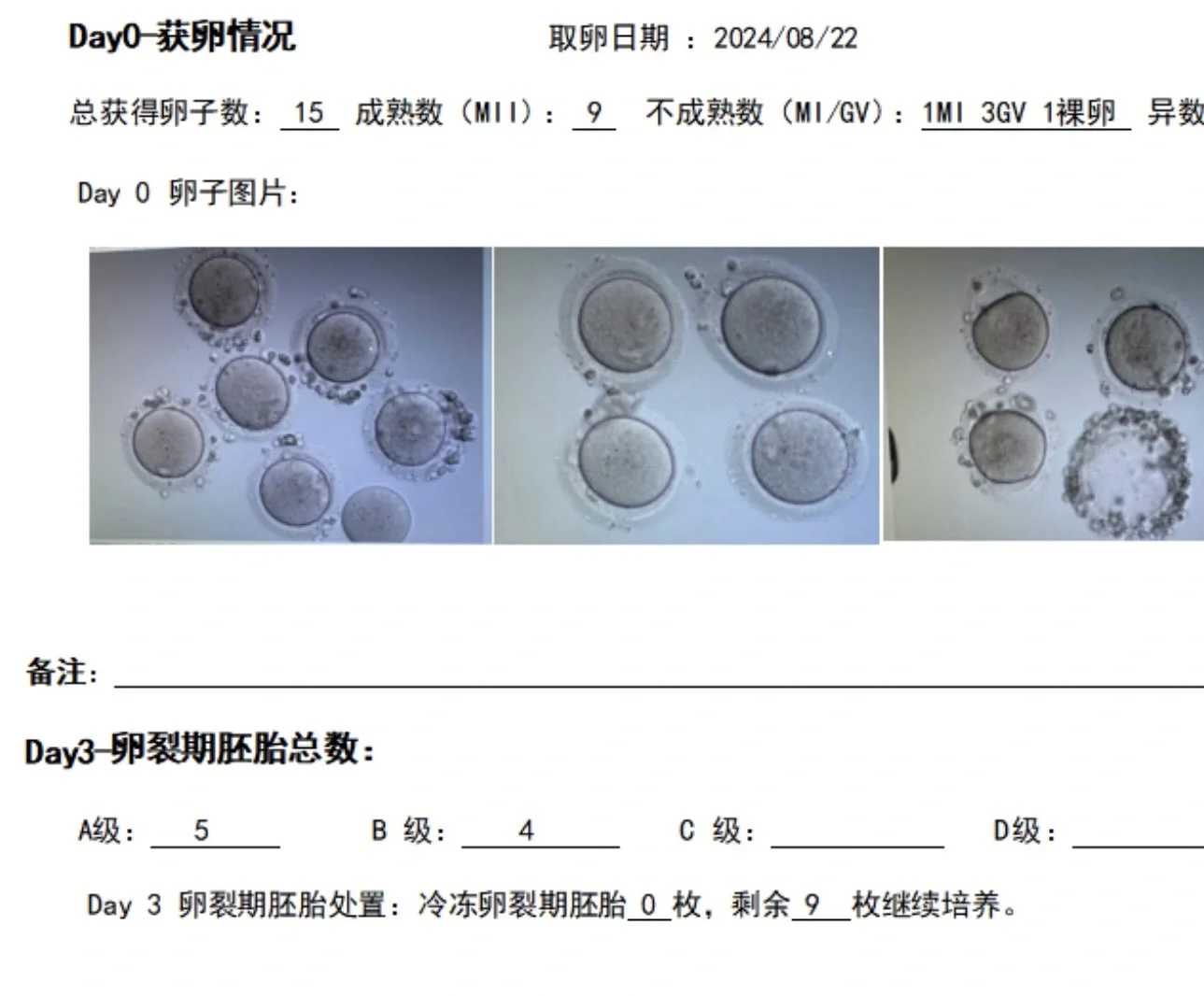 代孕公司排行_最专业的代孕网,影响试管婴儿胚胎的主要原因竟是染色体异常？