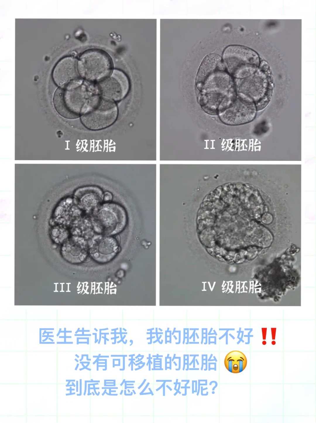 代孕儿子多少钱,不完全纵膈子宫患者生孩子,送你3种实践有效的方法!